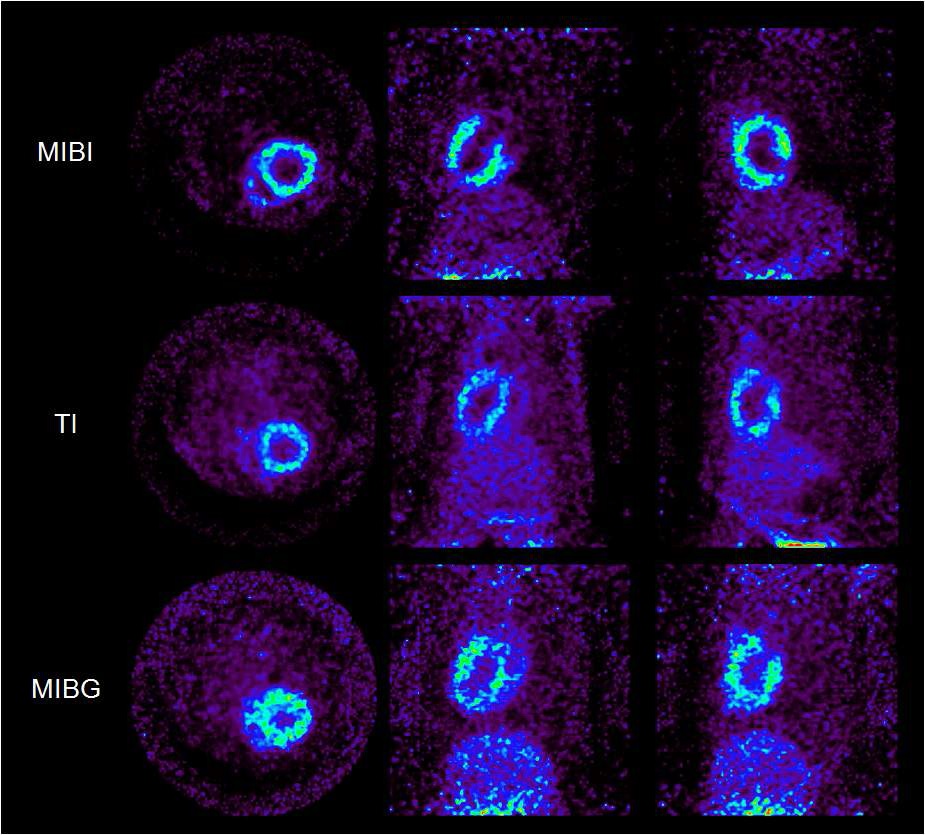 그림 7. 소동물 SPECT를 이용한 Tc99m-MIBI, Tl201, I123-MIBG 영상