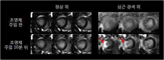 그림 13. 정상 쥐와 심근경색 모델 쥐의 지연기 조영증강 MR 영상 비교