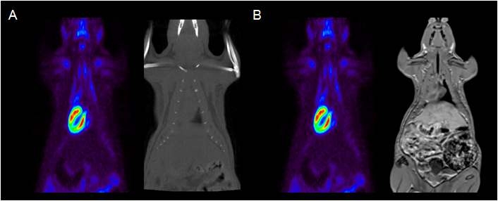 그림 15. 정합을 위해 획득된 PET/CT/MRI 영상