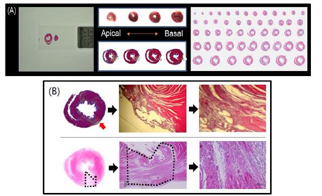 그림 45. H&E 염색을 통한 심근경색영역 정의