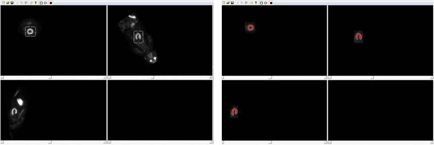 그림 27. PET 영상 심장영역 추출 및 심근영역 설정