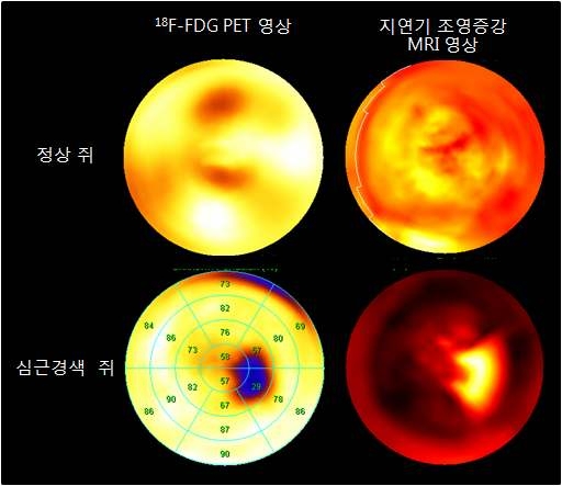 그림 32. 정상 쥐와 심근 경색 모델 쥐의 PET/MRI 극성지도 제작