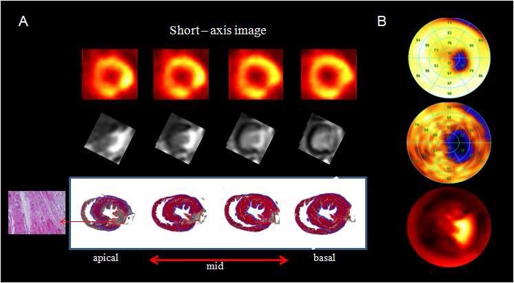 그림 46. 조직학적 영상과 극성지도 비교. (A) PET/MRI의 심근경색 모델 단축 영상과조직학적 영상,