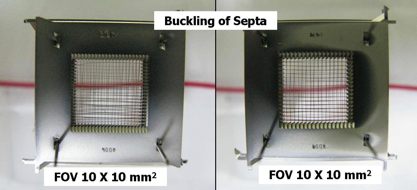 제작된 비산란 그리드/콜리메이터 (FOV: × ) septum의 좌굴