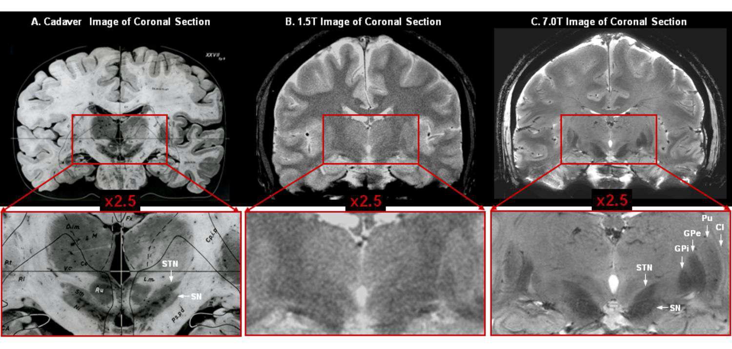 (A) Cadaver 영상, (B) 1.5T in-vivo 영상, (C) 7.0T in-vivo 영상.