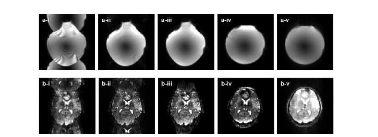 (a) phantom 과 (b) human 의 실험결과: i. 왜곡된 EPI 영상 ii. 기존 방법을 통한 nyquist ghost 제거 결과 iii. 개발한 방법을 통한 nyquist ghost 제거 결과 iv. iii의 영상의 왜곡 보정 결과 v. 비교를 위한 reference 영상