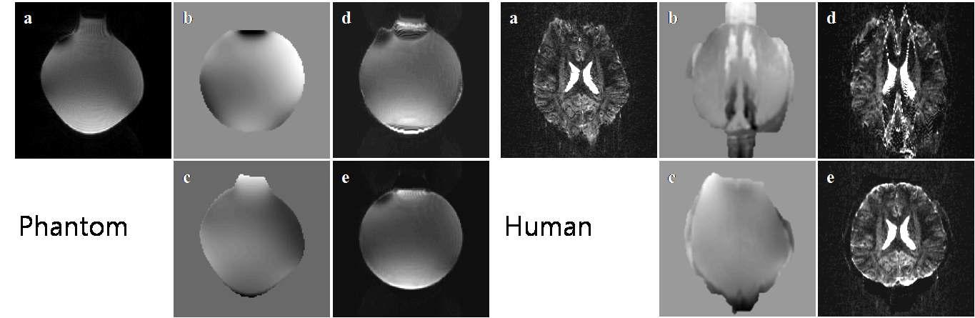 Phantom과 human 실험결과