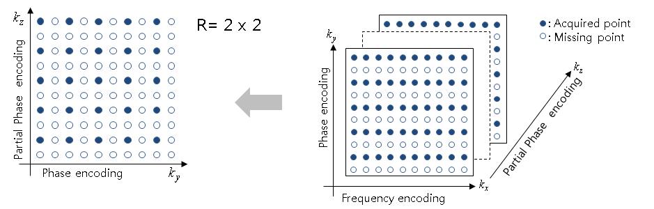 언더 샘플링된 3차원 k-space trajectory