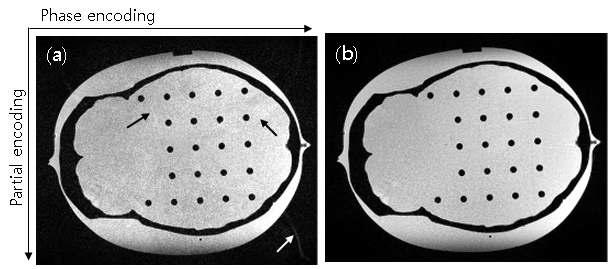 3차원 영상 복원 결과 (a) 2D-GRAPPA-OP (b) 3D-GRAPPA