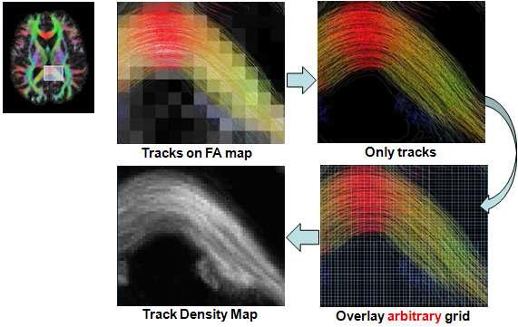 Track Density Imaging 영상 처리 flow chart