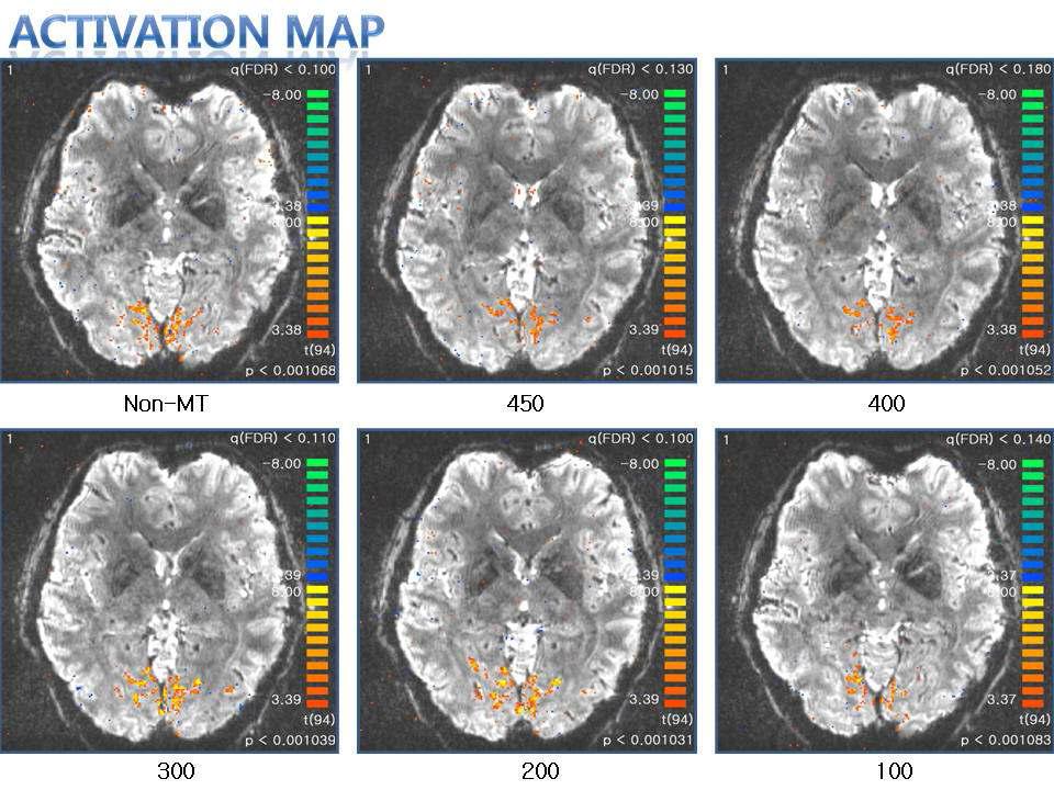 Magnetization transfer를 이용한 fMRI 실험 결과