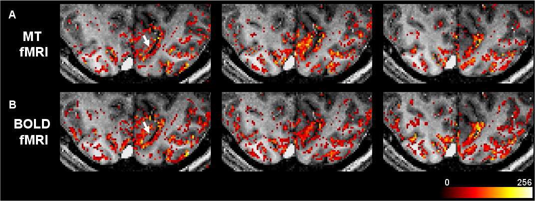 (위) 자화 전이 fMRI를 이용한 시각 자극 결과와 (아래) 일반BOLD fMRI를 이용한 시각 자극 결과