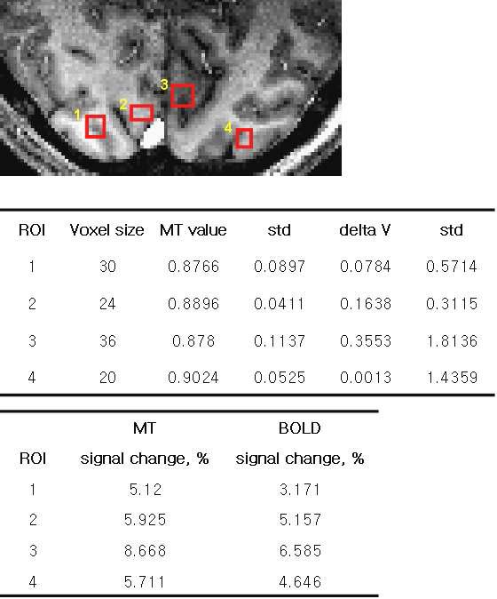 자화전이 fMRI를 이용한 시각자극결과에 대한 ROI 분석 결과