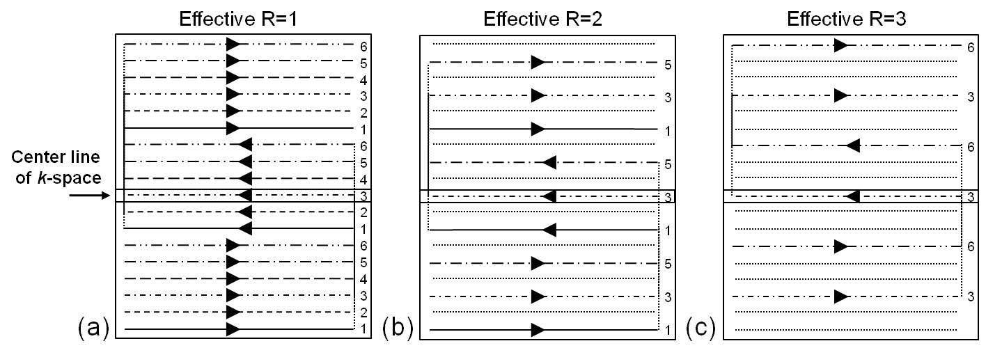 k-space trajectories of ci-EPI with 6 segments and (a)R=1, (b) R=2 and (c) R=3 (R; reduction factor