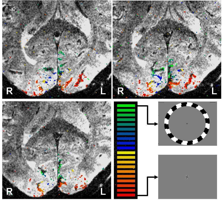 Neural response for the expanding ring