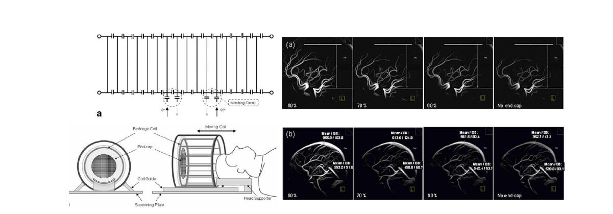 (좌) 최적화 혈관 영상을 획득 위한 코일 테스트, (우) End-cap 종류에따른 혈관 영상의 최적화