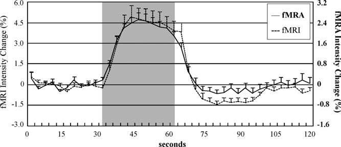 뇌기능 혈관 영상 (fMRA) 과 뇌기능 영상 (fMRI) 의 평균신호 변화 (회색 부분 30초 동안 시각 자극 유지)
