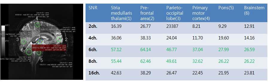 각 채널수의 따른 human Brain 영상에서 신호 대 잡음비의 비교