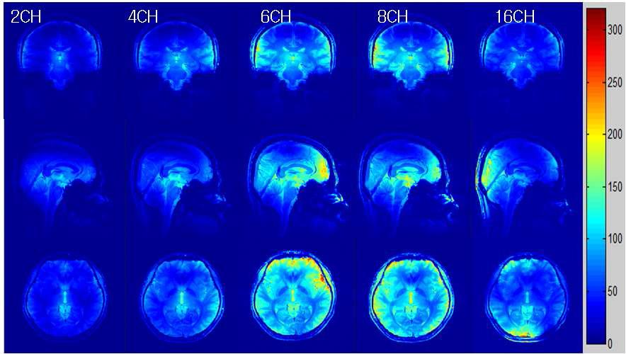 각 채널수의 따른 human Brain 영상의 자기장의 분포의 비교