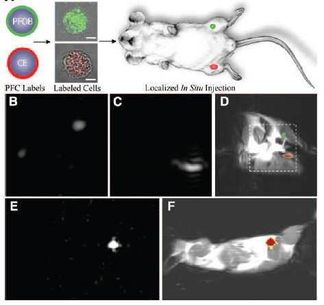 나노조영제를 포함한 줄기세포를 이식한 동물(mouse)모델에서 MRI 영상을 하여 줄기세포의 위치를확인 함.