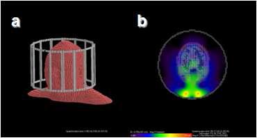 (a) 유한요소법을 이용한 시뮬레이션 모델의 구조, (b) 16 channel TX coil에 Human head model을 삽입한 시뮬레이션 모델의 field pattern