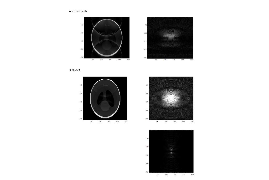 Auto-smash 방법과 GRAPPA 방법의 비교