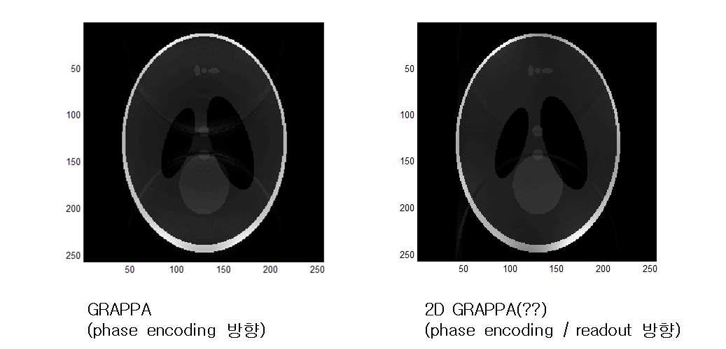 GRAPPA vs. 2D GRAPPA의 결과 비교