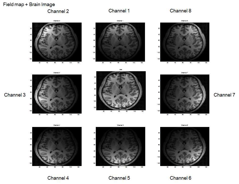 Simulation을 위한 원본 영상(가운데)과 8채널 RF 코일의 field map을 곱하여 얻은 8채널 병렬 이미지