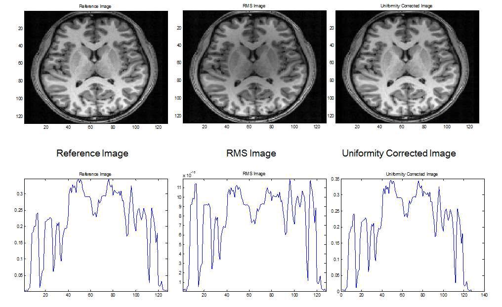 원본 이미지(좌), RMS을 통하여 재구성된 이미지(가운데)와 Uniformity correction에 의하여 재구성된 이미지(우)의 비교 및 signalprofile 비교