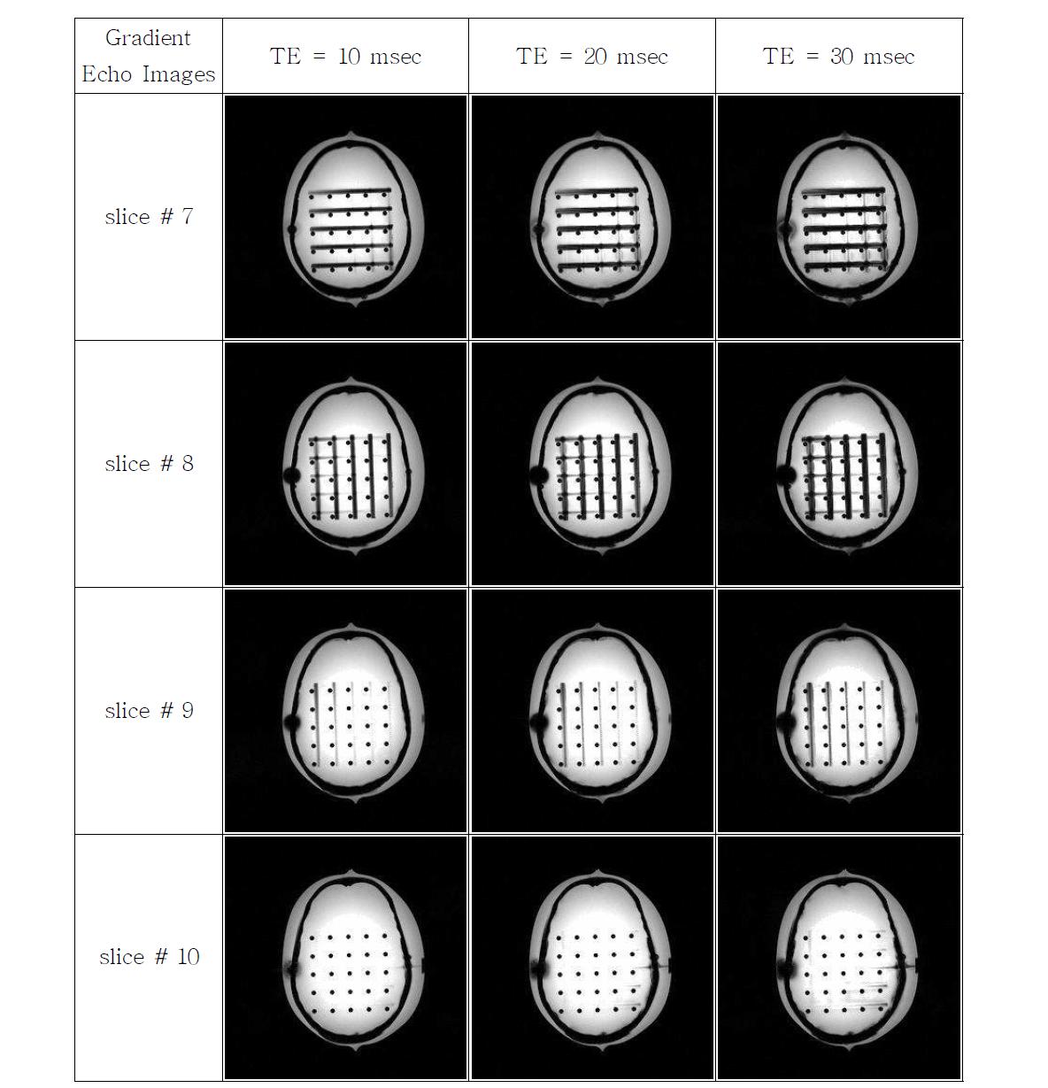 3.0T 고자장 MRI System에서 Echo Time의 변화에 따른 영상 변화