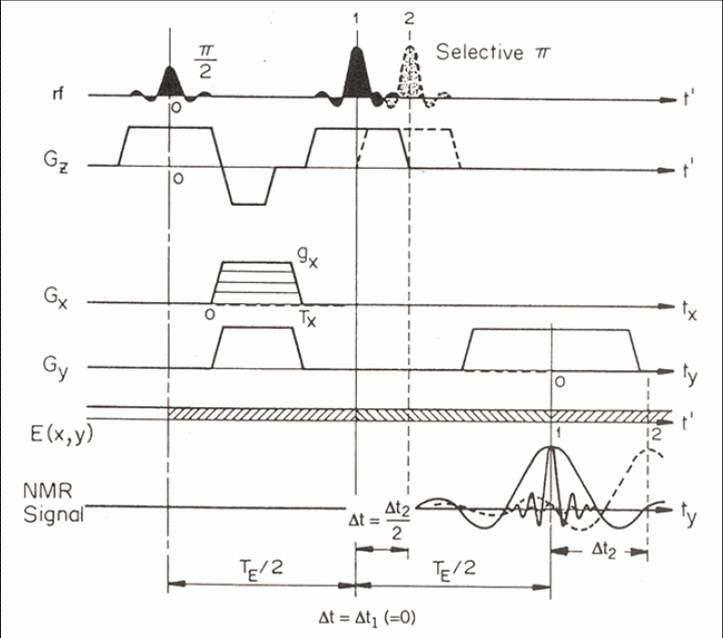 SWEET Pulse Sequence