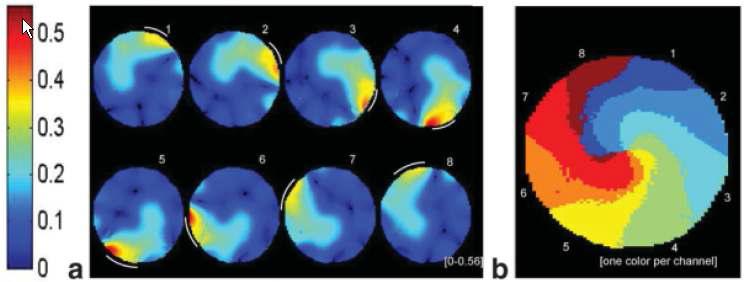 (a) Relative intensity map for the eight elements obtained by dividing each coil element magnitude image by the sum of all magnitude images (SOM). (b) Map showing, for each pixel at location r, which one of the eight channels (one arbitrary color per channel) contributes the most in signal intensity.