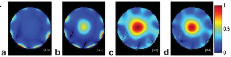 Comparative image summations (sphere phantom).