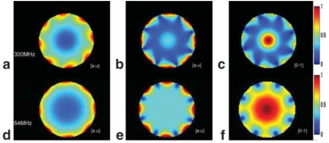 Comparative transmit B 1 field summations from simulation data at 300 MHz (a, b, c) and 64 MHz (d, e, f). (a) and (d) Sum of the eight transmit magnitude maps. (b) and (e) B 1 transmit magnitude map. (c) and (d) Ratio of, respectively, the map in shown b over the map shown in a and the map shown in e over the map shown in d.