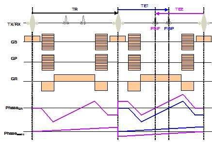 DESS sequence for 3D Shimming