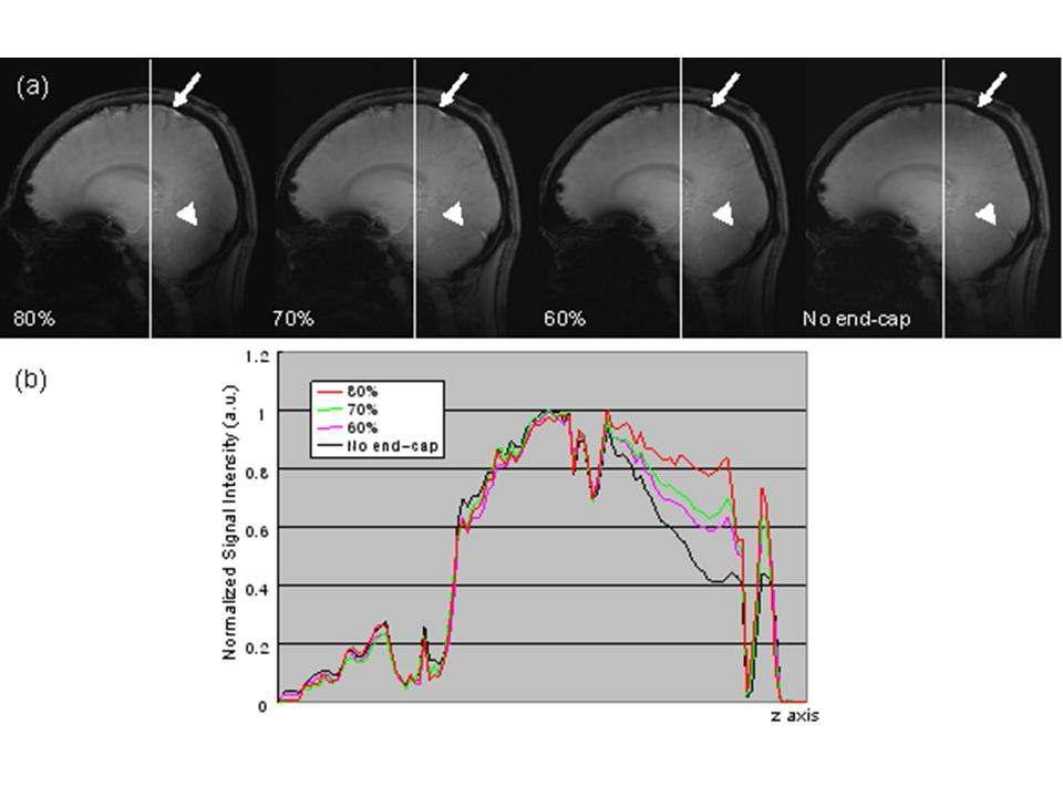 End-cap의 크기에 따른 MRI 영상과 각 영상신호의 신호 세기 그래프