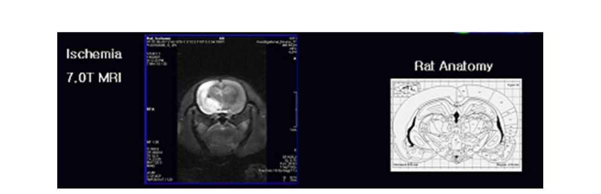 동물용 coil의 뇌졸중 모델쥐의 적용