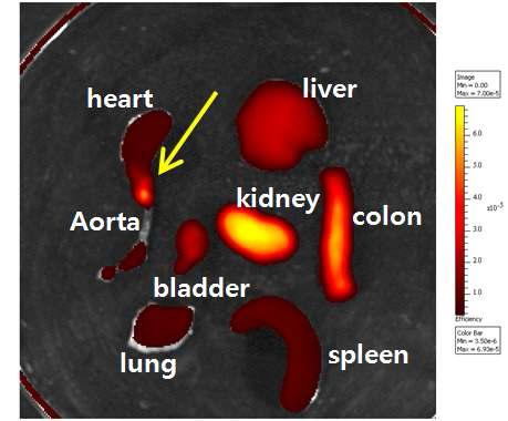 Cy5.5-Tenascin C 압타머 1 nmole을 주사한 후 얻은 APOE 마우스의 체내 분
