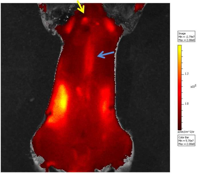 Cy7-Tenascin C 압타머 1nmole 주사후 얻은 APOE 마우스의 영상. 대동맥 기시부(yellow arrow)와 하행대동맥(blue arrow)에 형광이 검출되어 동맥경화반에 타겟팅됨을 확인할 수 있음.