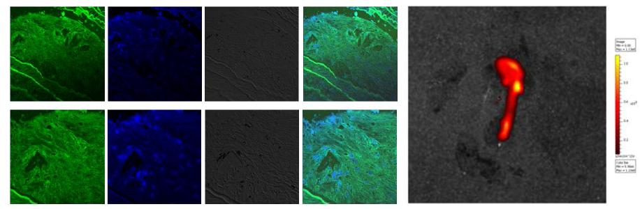 APOE KO 마우스의 대동맥 죽상경화반 조직에 sE-selectin 압타머를 처리한 후 얻은 confocal 영상 (좌)과 sE-selctin 압타머 투여한 APOE마우스에서 얻은 대동맥의 ex vivo 광학영상. 조직학적으로 plaque형성 부위에 형광이 관찰됨을 볼 수 있음. 광학영상을 통하여 대동맥 기시부에 형광이 관찰됨을 확인하여 죽상경화반 타겟 영상용 프로브로 이용 가능함을 보임.