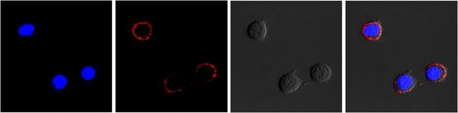 BT-20 세포주를 MFBR-MUC-1 aptamer 로 처리한 후 얻은 confocal 영상. 세포벽에서 형광이 확인됨.