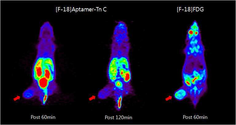 F-18 표지 압타머를 정맥주사한 후 60분과 120분에 얻은 PET영상. 종양부위에 타겟팅 됨을 확인할 수 있음.