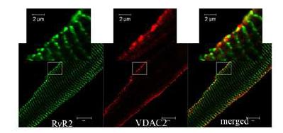 심근세포에서 VDAC2와 RyR2의 공존