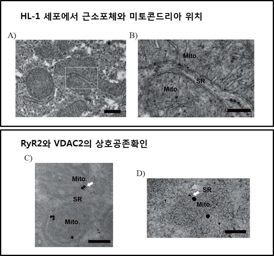 전자현미경을 이용한 HL-1세포 이미징
