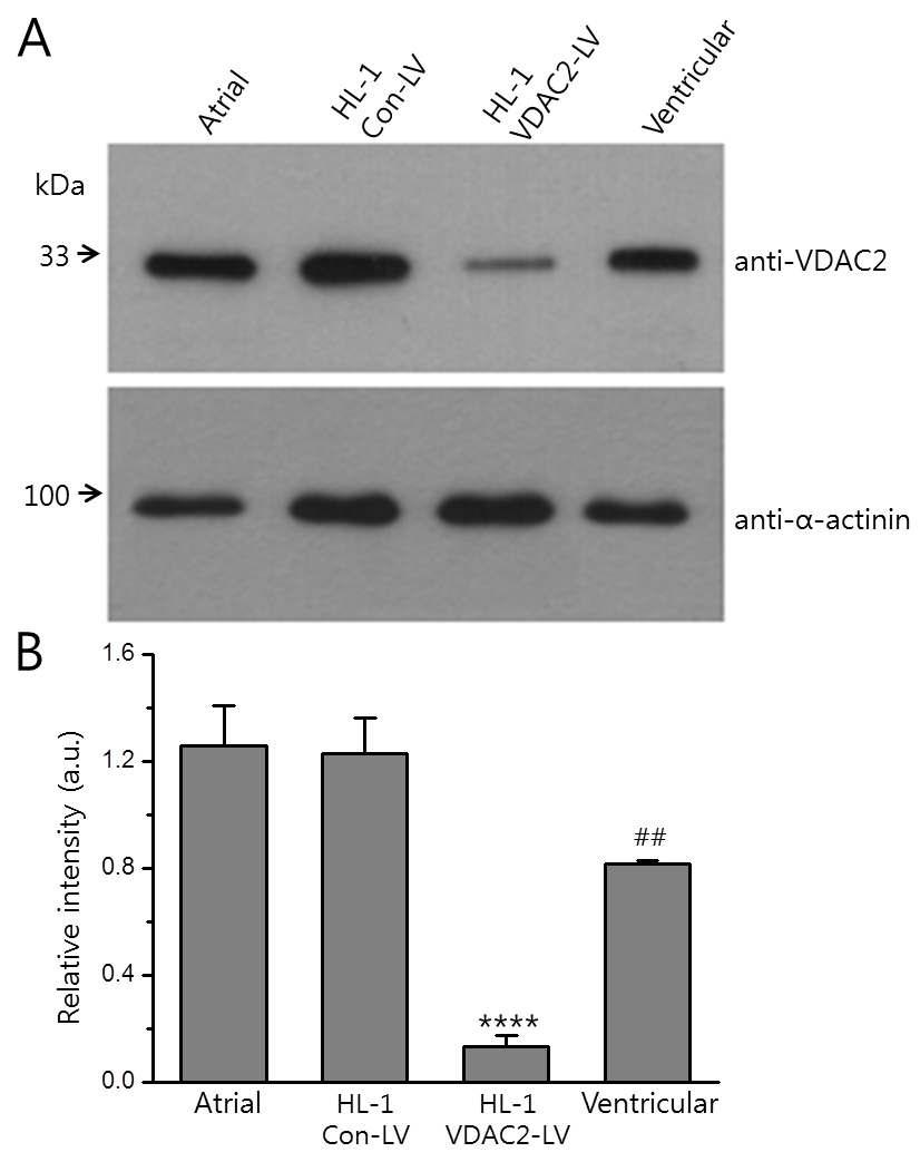 심근세포와 렌티 바이러스를 이용해 VDAC2를 넉 다운시킨 세포에서 VDAC2의 발현. Western blot을 이용한 VDAC2의 발현 정도 측정(A). VDAC2는 심근세포와 HL-1세포에서 높게 발현되었으나 VDAC2 mRNA를 표적으로 한 렌티바이러스 감염 HL-1 세포에서는 VDAC2 단백질의 발현이 현저하게 감소함(B).
