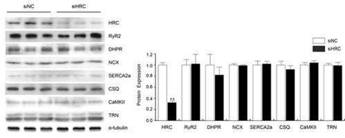 HRC 발현 억제 모델에서의 다른 칼슘대사 관련 단백질의 발현양
