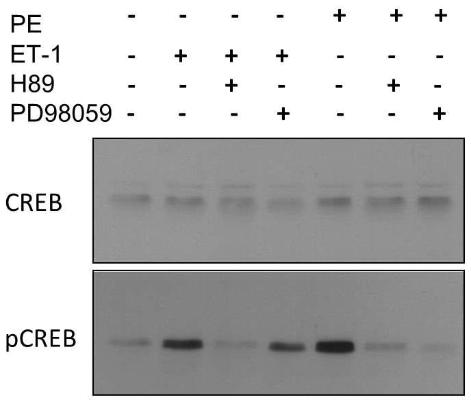 H89와 PD98059(각 각 MSK1 & PKA, ERK 1/2 저해제)에 의한 ET-1, PE 유도성 CREB 인산화의 저해.
