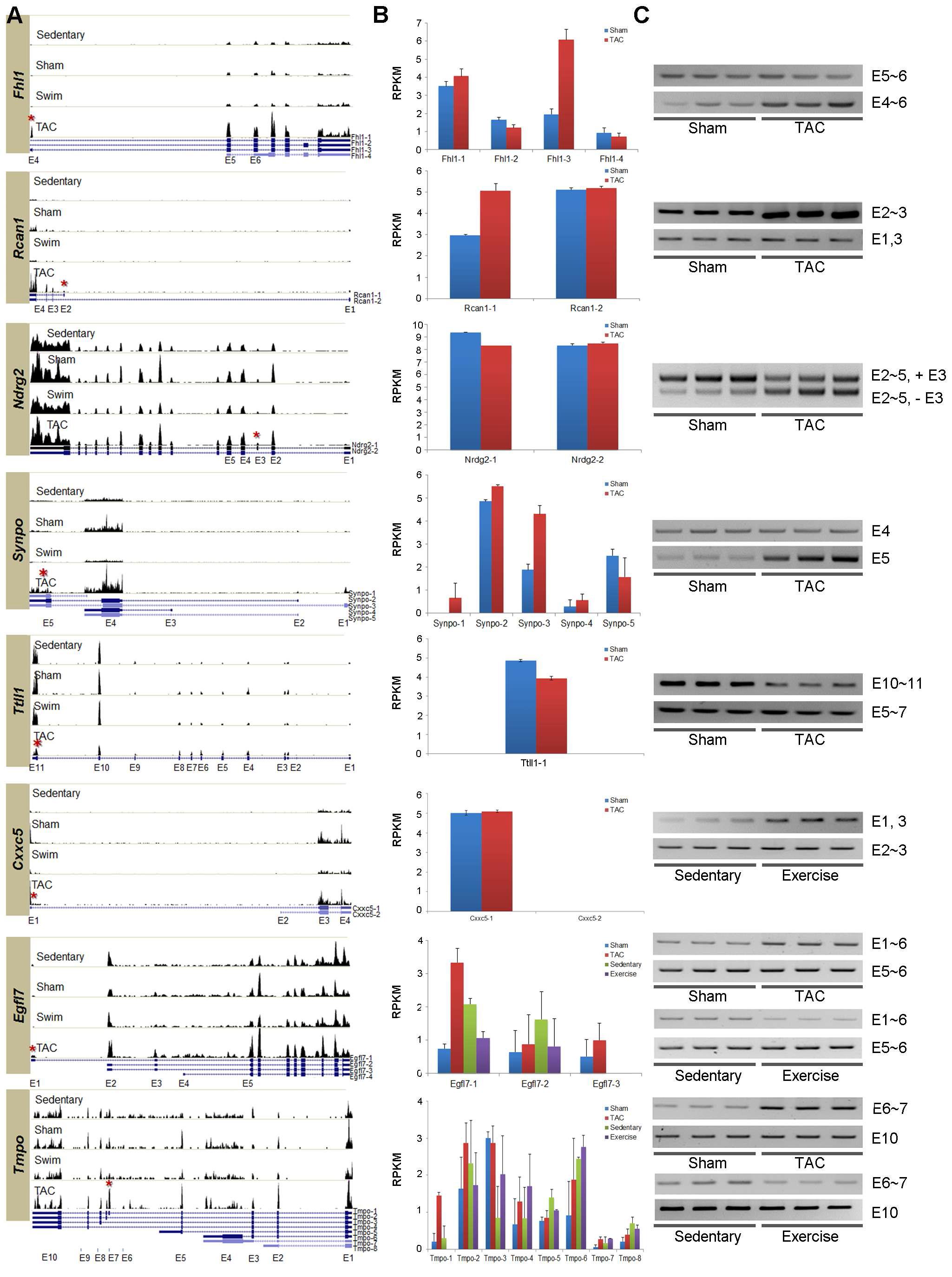 생리학적 및 병리학적 심근비대에서 나타나는 exon variants 분석 (A) 8개 유전자의 exon 별발현 히스토그램 (B) NEUMA로 분석한 isoform 패턴 (C) RT-PCR로 검증한 exon variants