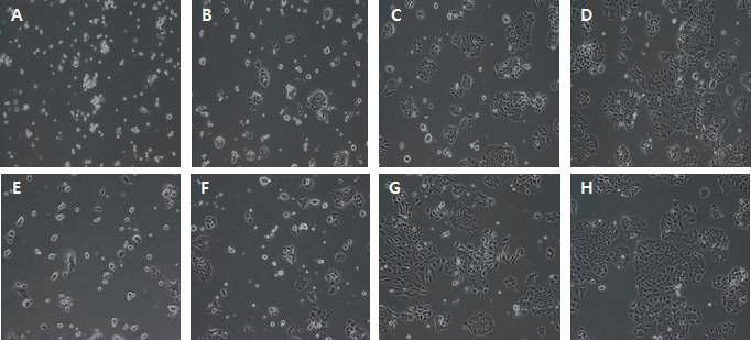 Effect of TMC and Carboxylic TMC on growth of HCT-15 cells.