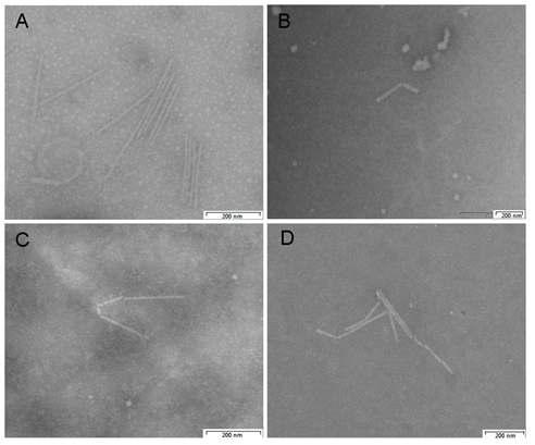 Electron micrographs of viral particle on leaf-discs from the leaf-disc methodwith a 200 nm scale.